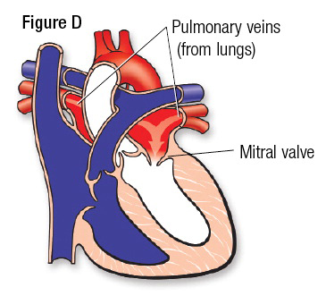 Heart Fig D