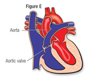 Heart Fig E